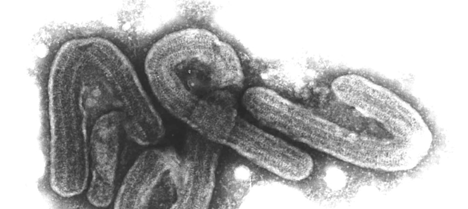 Ausbruch des gefährlichen Marburgvirus